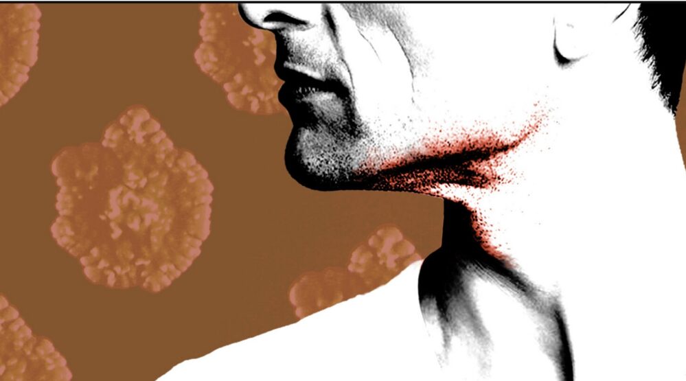 Skin Disease Among Gay Men in Europe