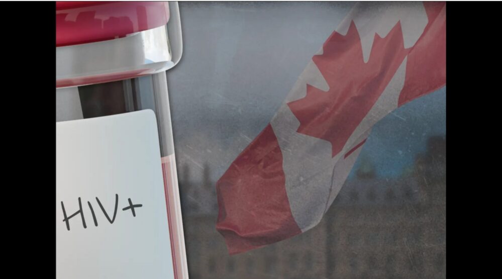 What’s Happening with HIV in North America?